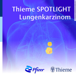 Spotlight_Lunge_Pfizer_312x175-min